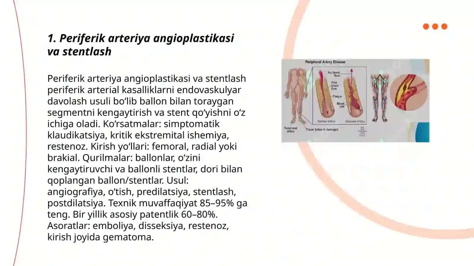 Arterial qon tomirlarini surunkali obliteratsiyasida zamonaviy davolash usullari 3