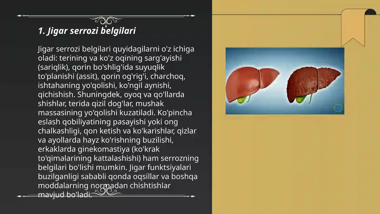 Jigar serrozi 3