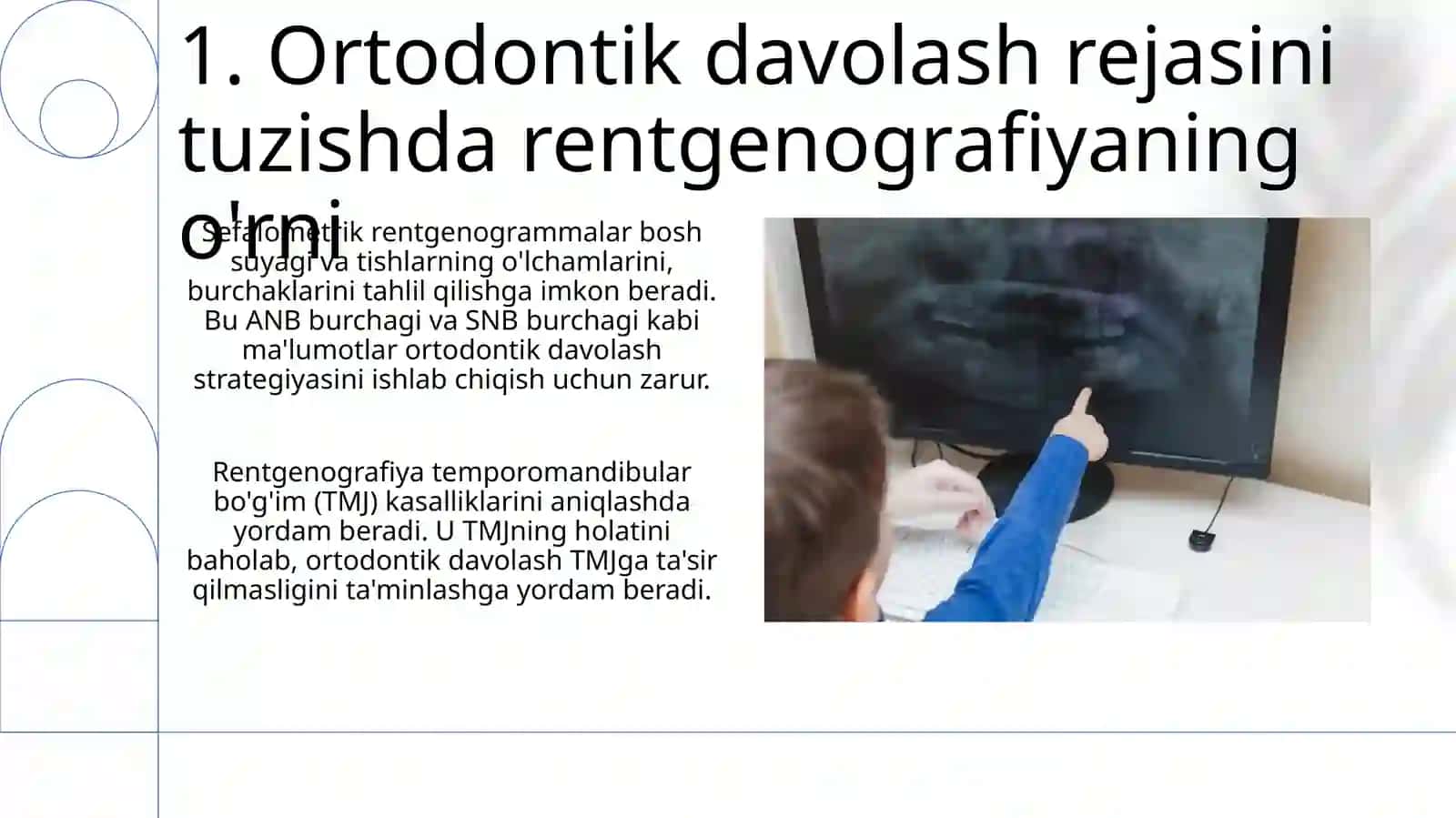 Ortodontik bemorlarni rentgenologik tekshirish usullarini o‘rganish 3