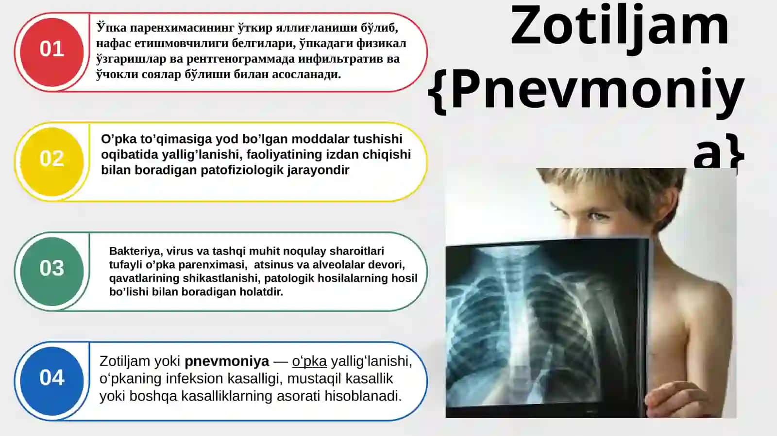 Zotiljam 3