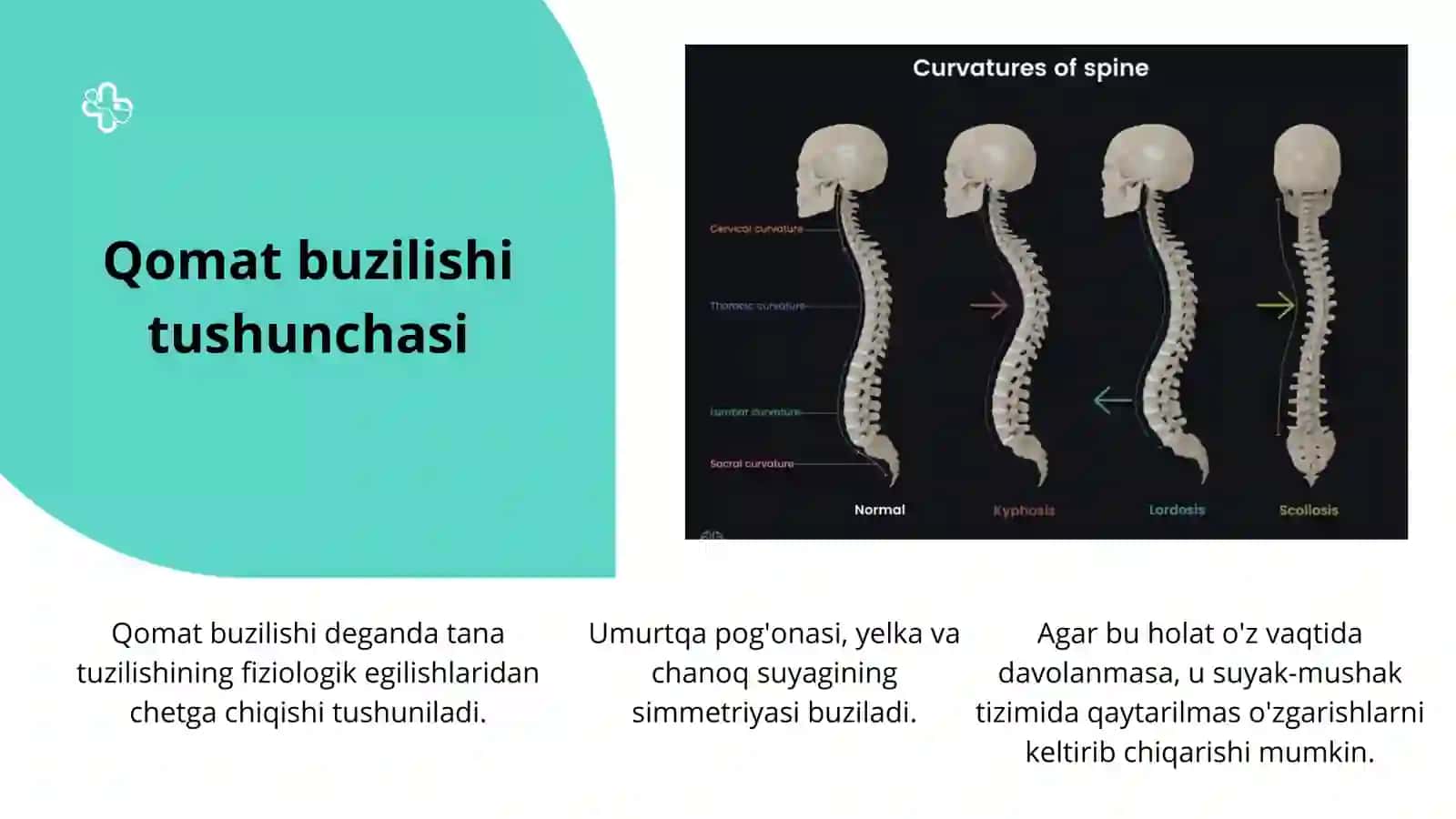 Bolalarda Qomat Buzilishi: Turlari, Sabablari va Oldini Olish — 15 Slaydli Taqdimot 3