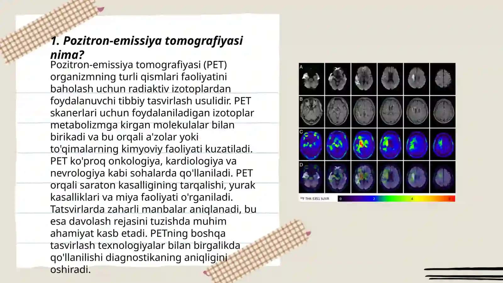 Pozitron-emissiya tomografiyasi (PET) 3