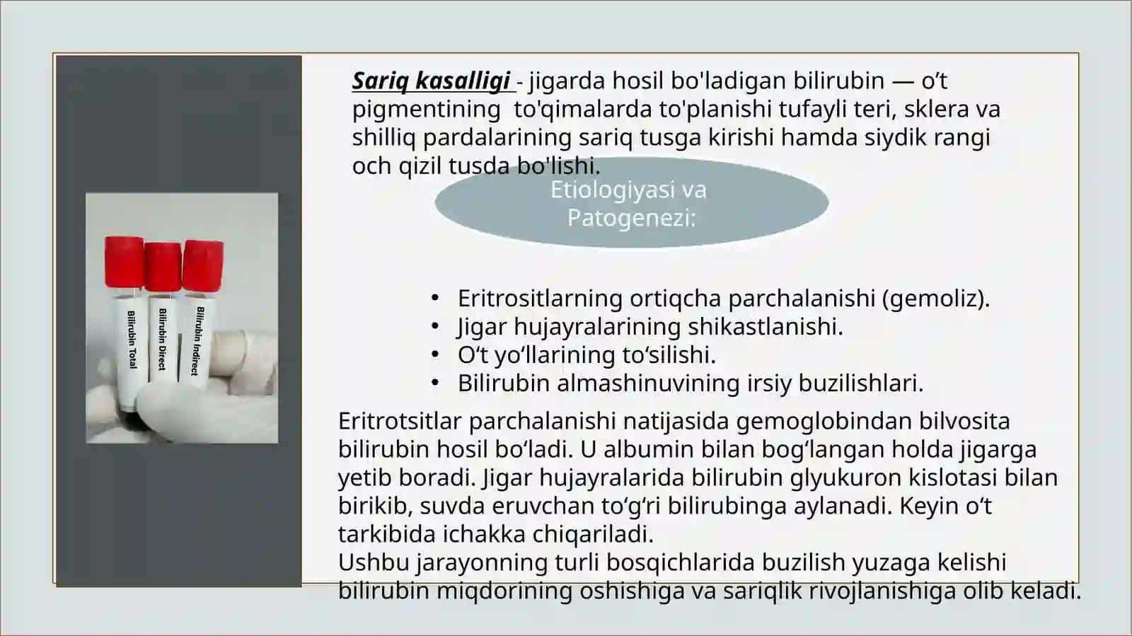 Sariqlik sindromi 3