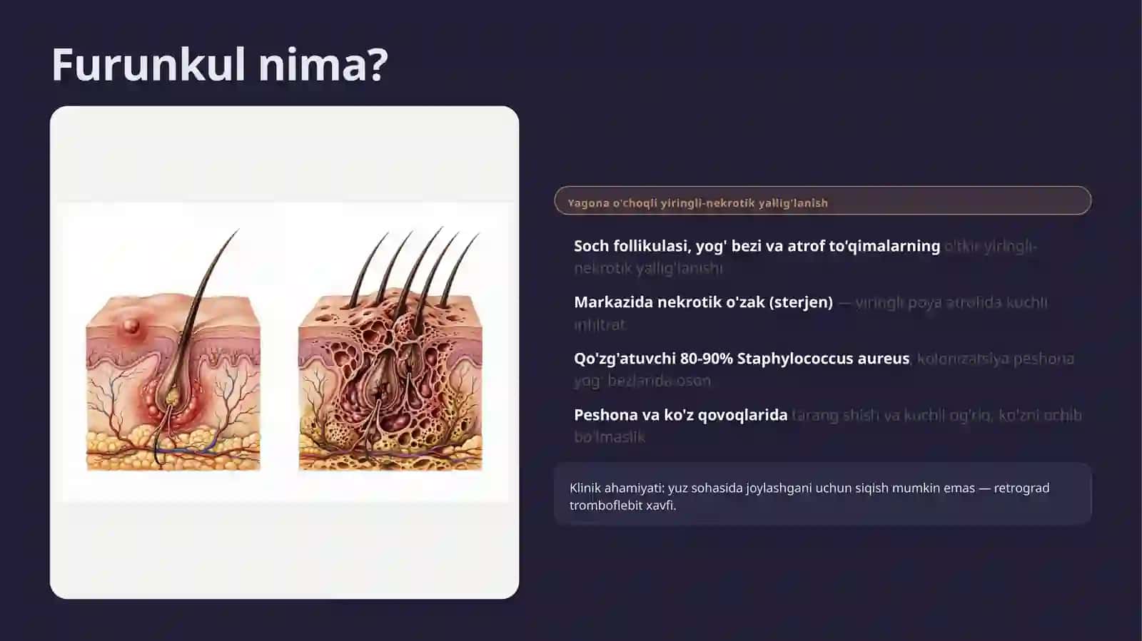 Peshona va Ko'z Sohalari Furunkul va Karbunkullari 3