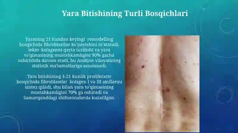 Chandiq Shakillanishida Fibroblastlarning Mexanizmlari 3