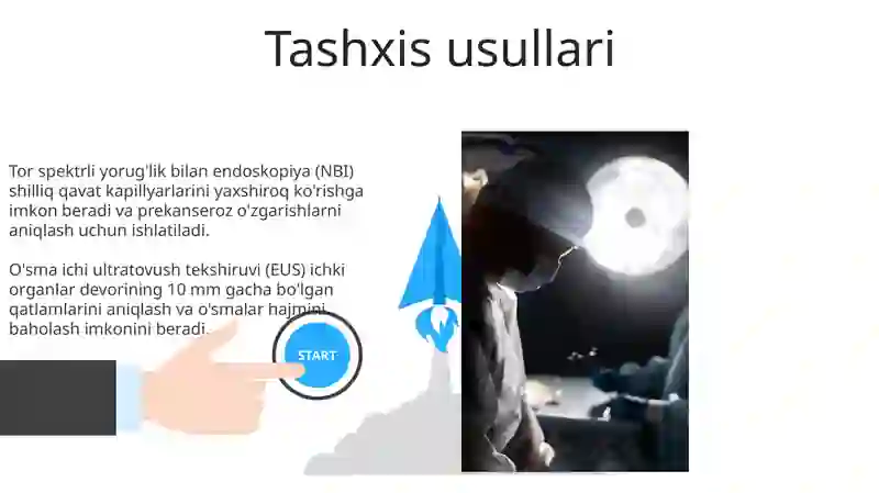 OIT da operativ endoskopiya 3