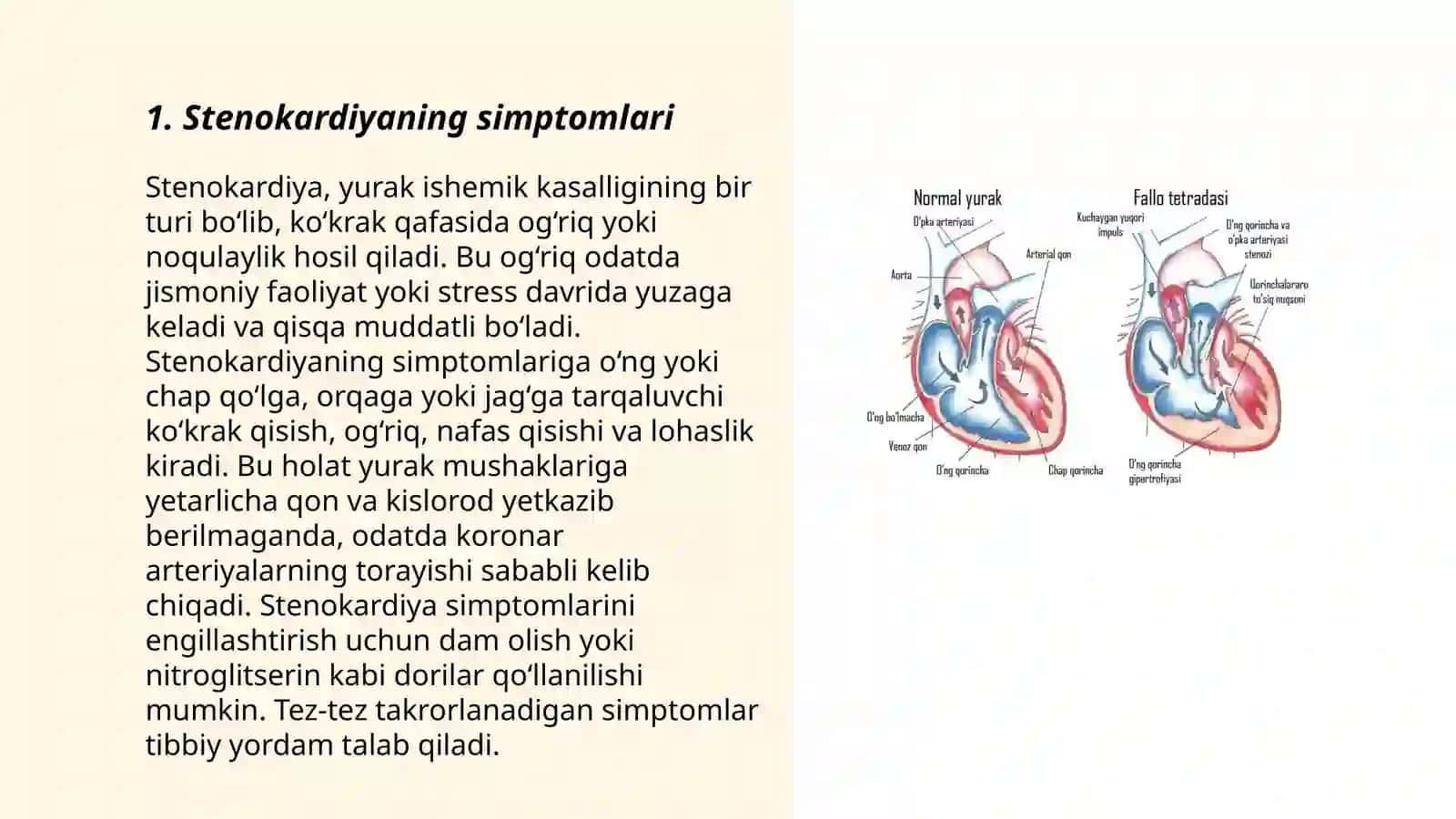 Stenokardiya miokard infarkti gipertonik kriz o'tkir yurak qon tomir yetishmasligi - Maxamadjonova Iroda 3