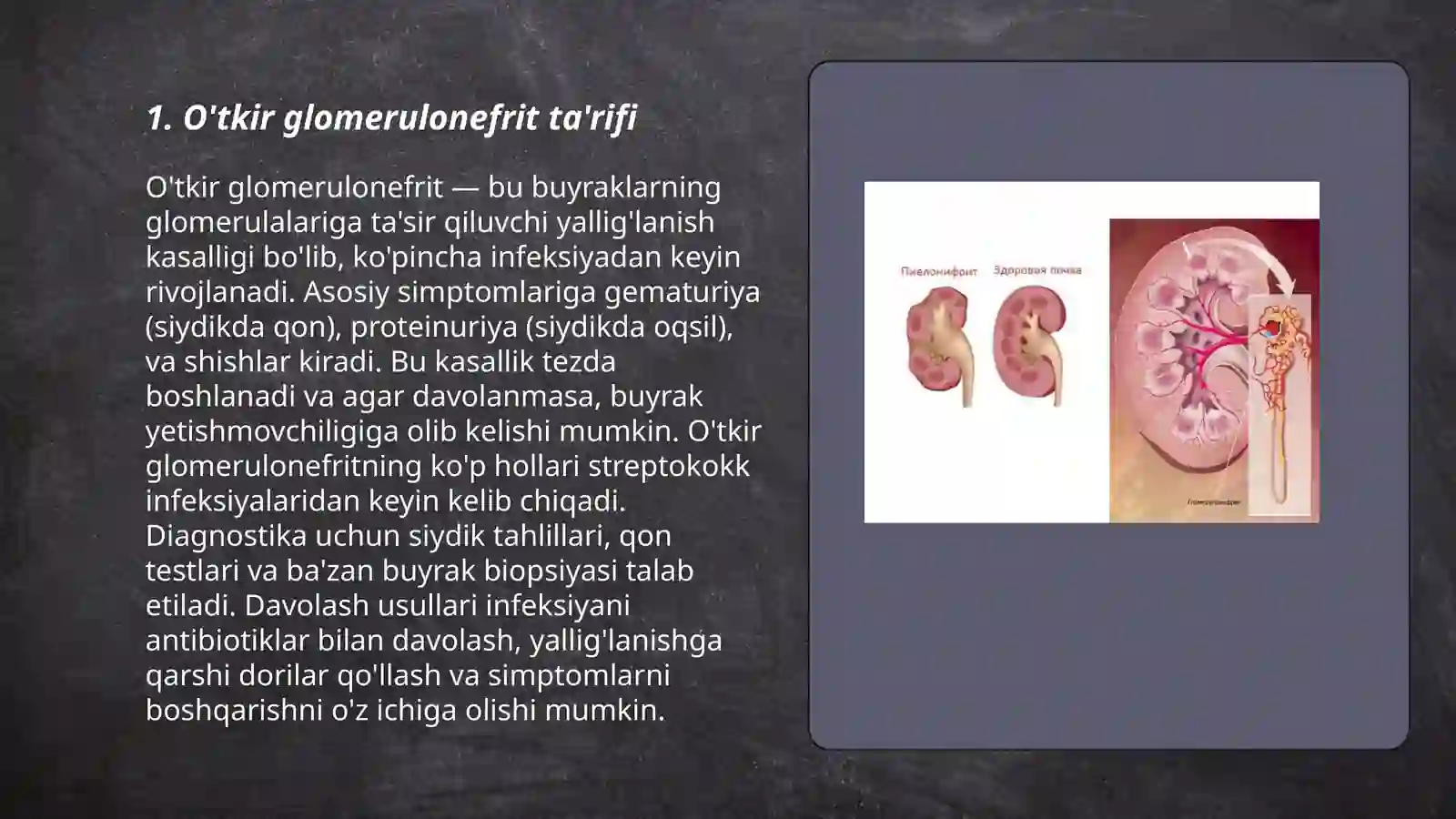 O'tkir Glomerulonefrit 3