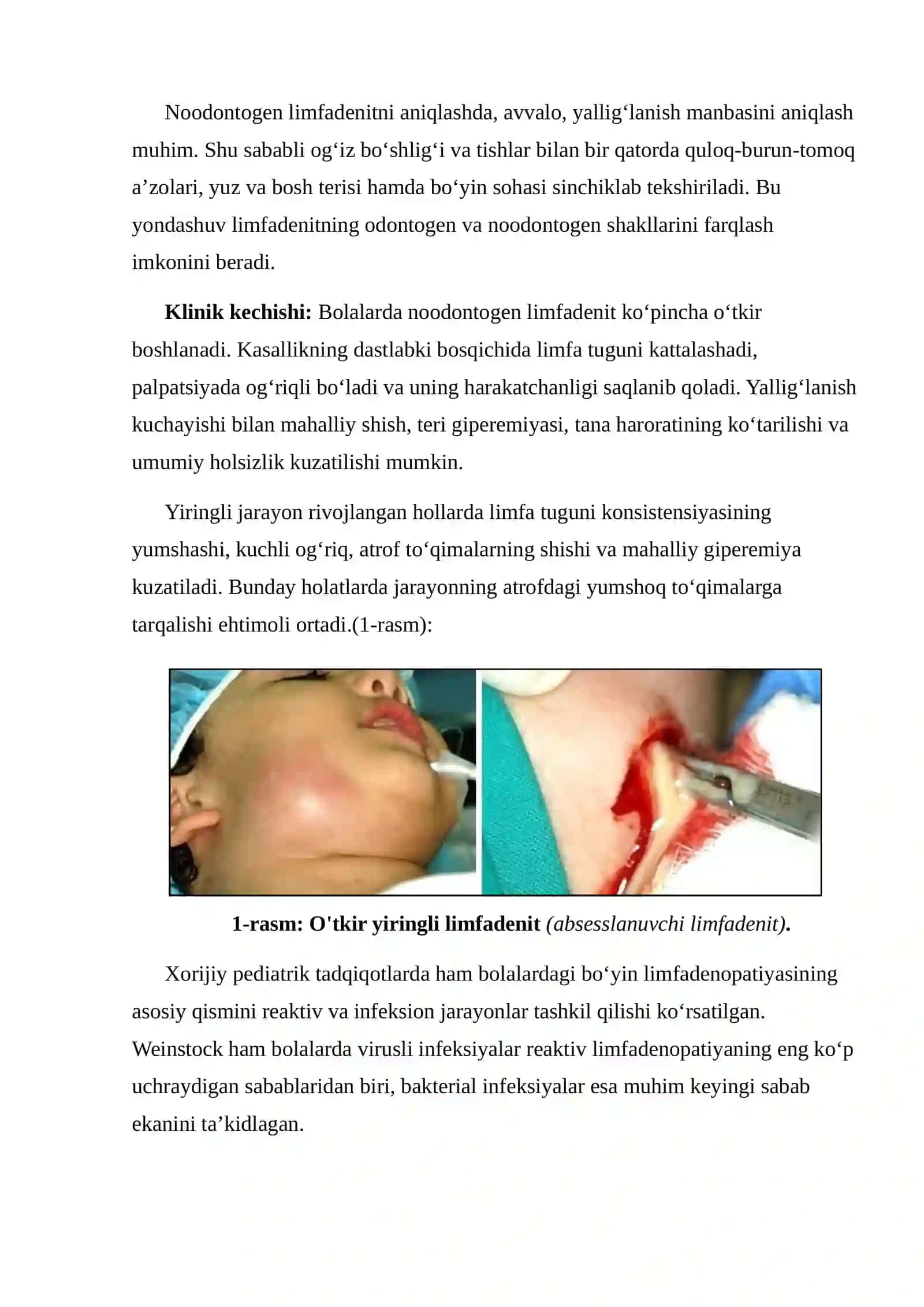 BOLALARDA YUZ-JAG‘ SOHASI NOODONTOGEN LIMFADENITLARINING KLINIK KECHISHI VA TASHXISLASH XUSUSIYATLARI 3