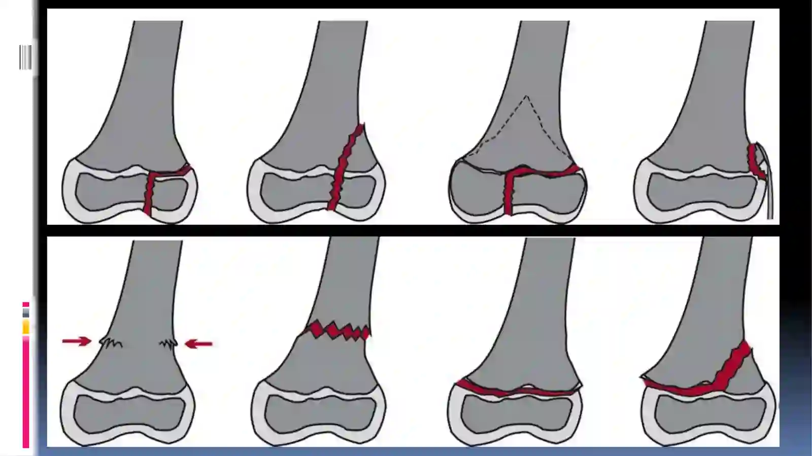 Xirurgiksinishlar 3