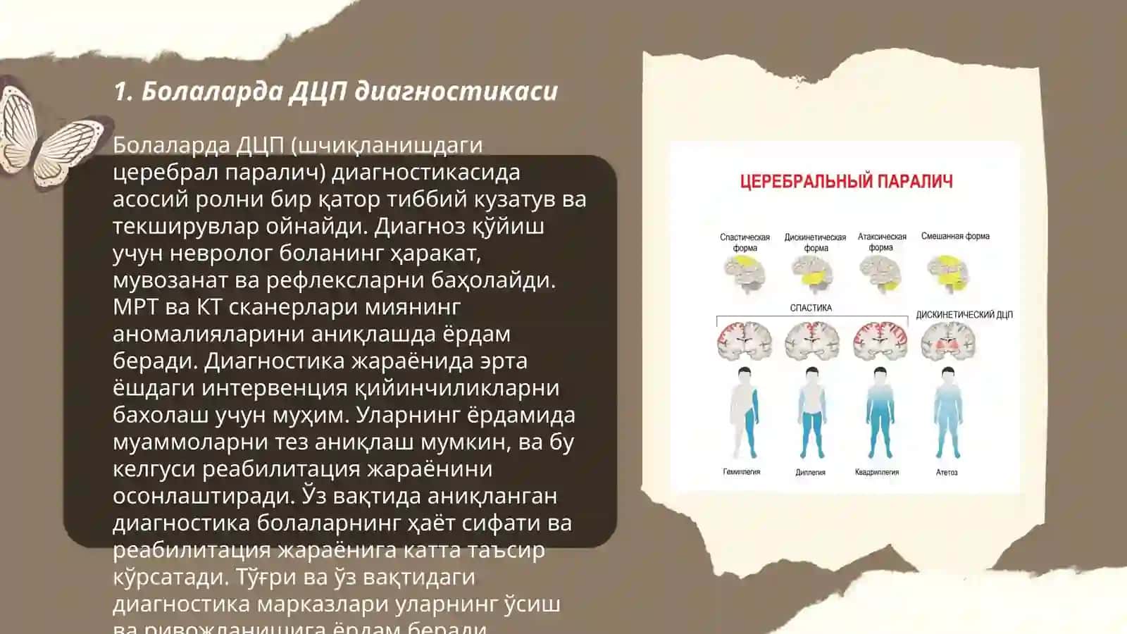 ДЦП yoki (bolalar miya falaji) kasalligi 3