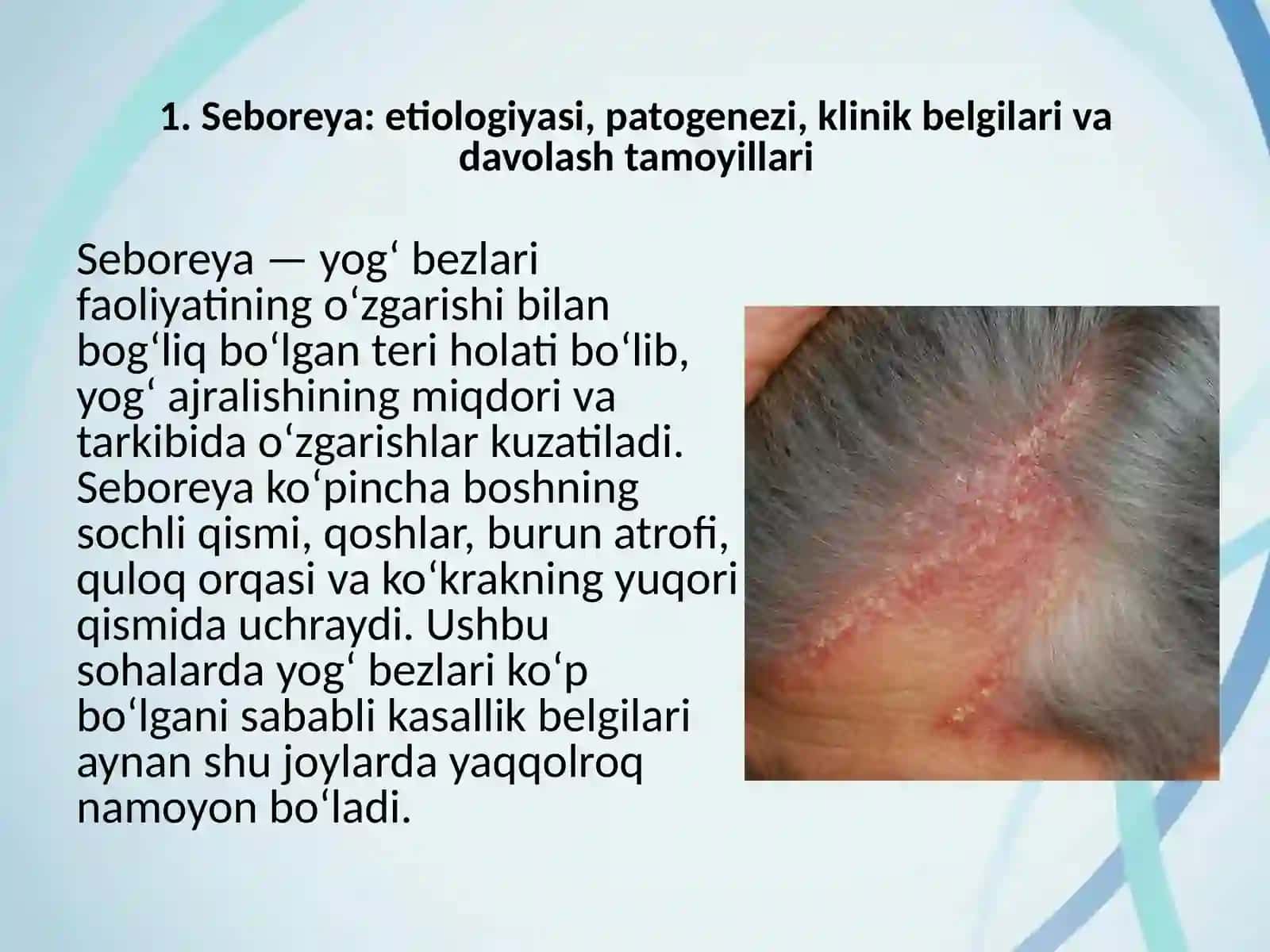 Seboreya. Pushti rangli xusnbuzarlar. Chaqaloqlarning yiringli kasalliklari 3