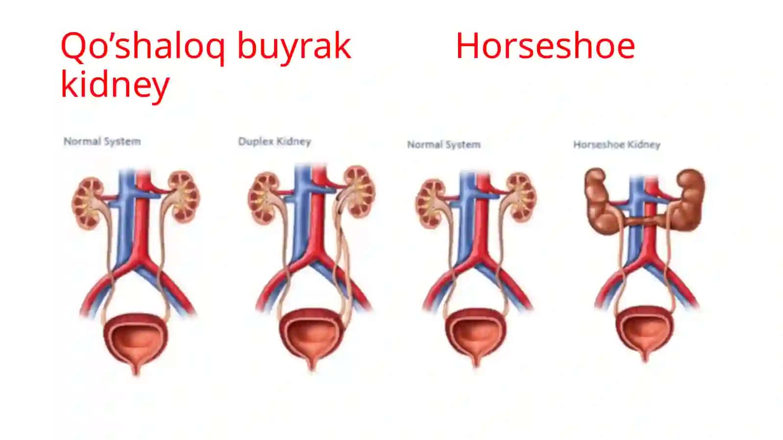 Buyrakdistopiyasi 3