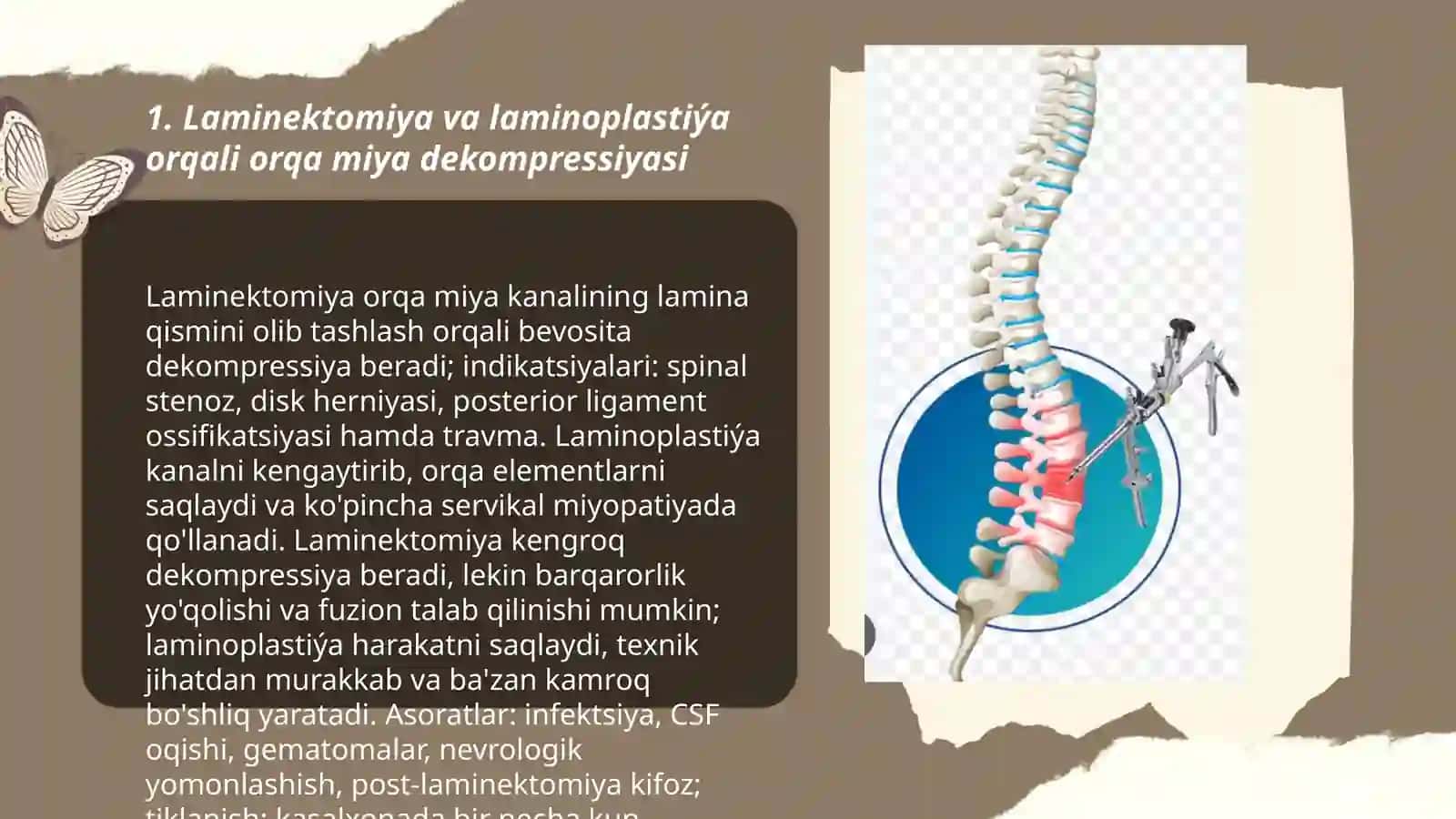 Umurtqa pog'onasi va orqa miya patologiyasida qo'llaniladigan amaliyot usullari 3
