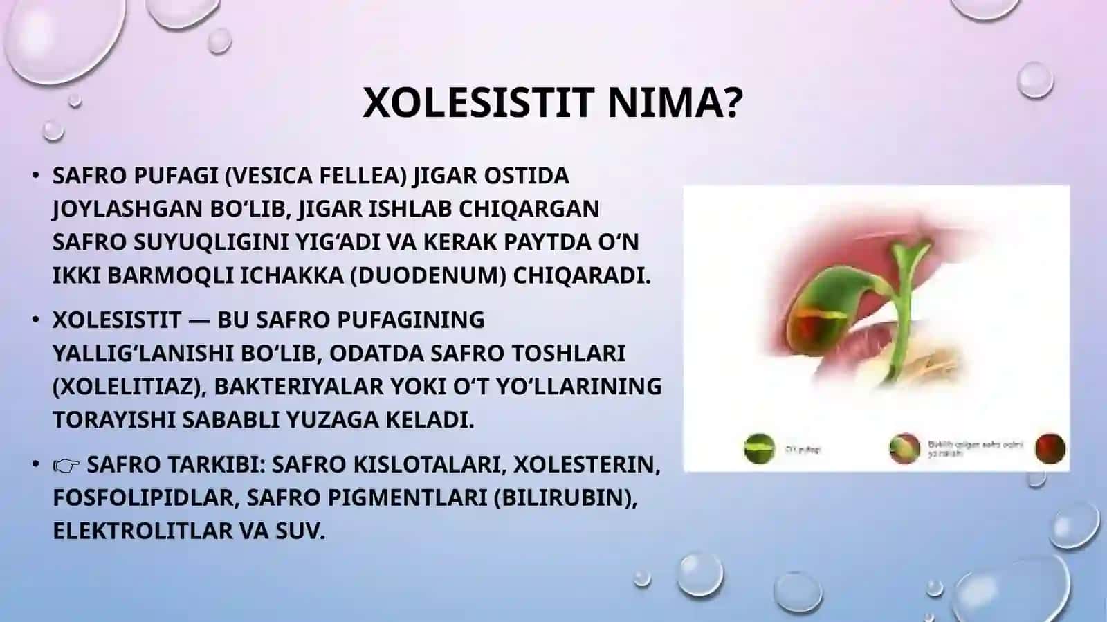 xolesistit 3