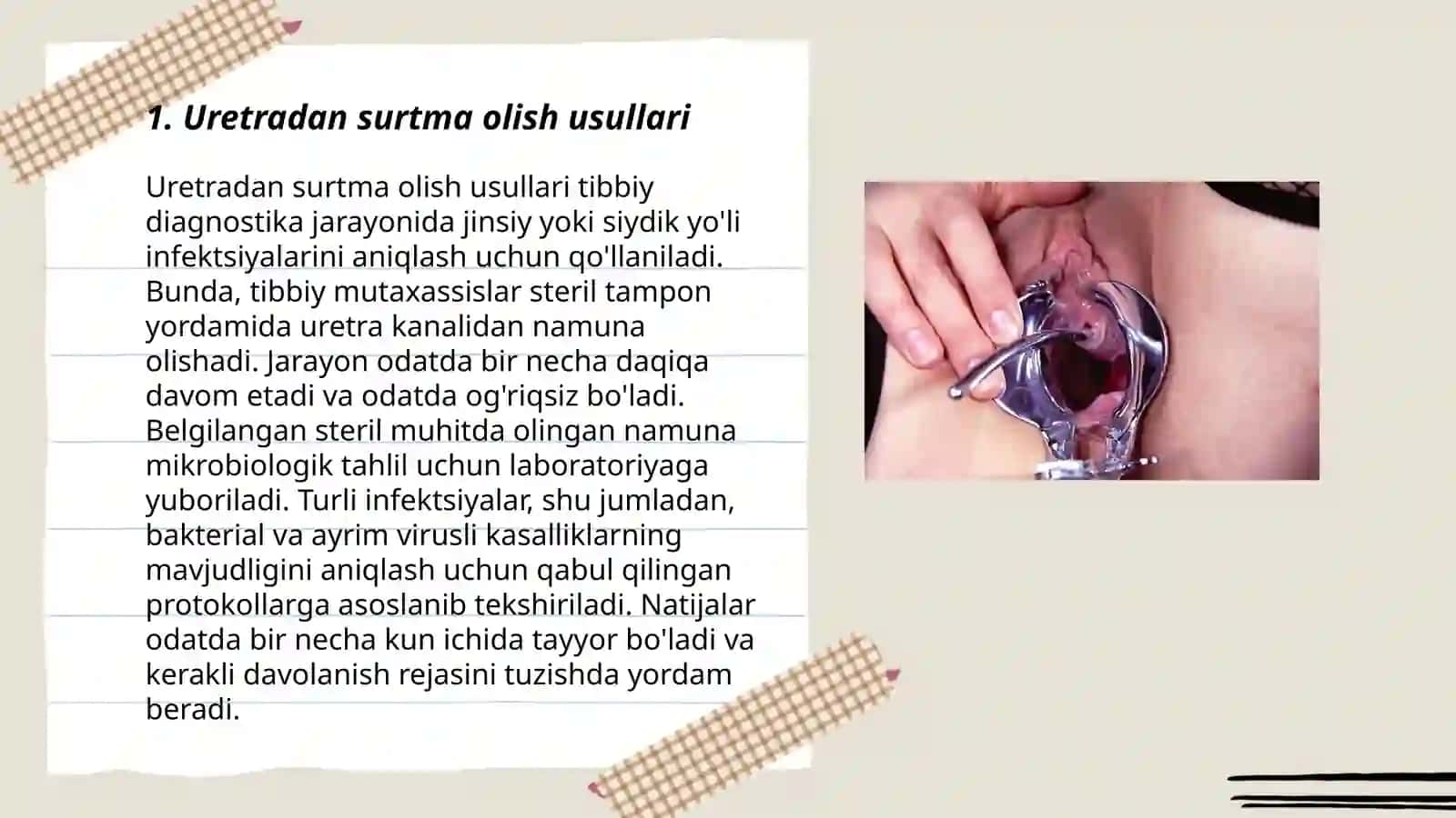 Uretradan va qindan surtma olish 3