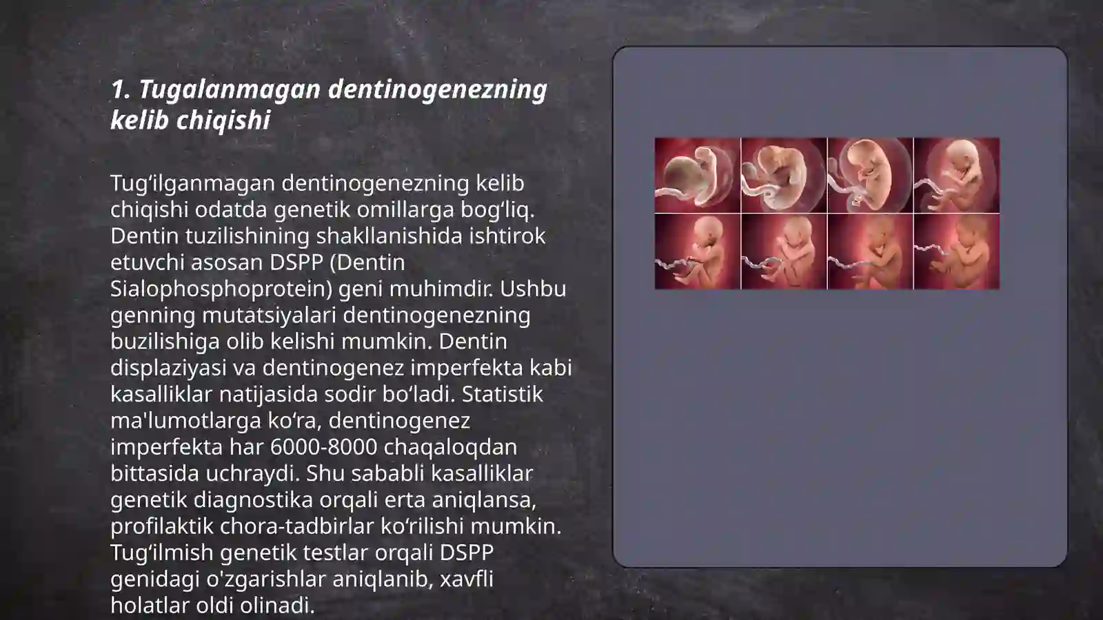 Tugalanmagan dentinogenez 3