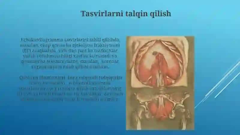 Ekokardiyografiyaning Asosiy Tamoyillari 4