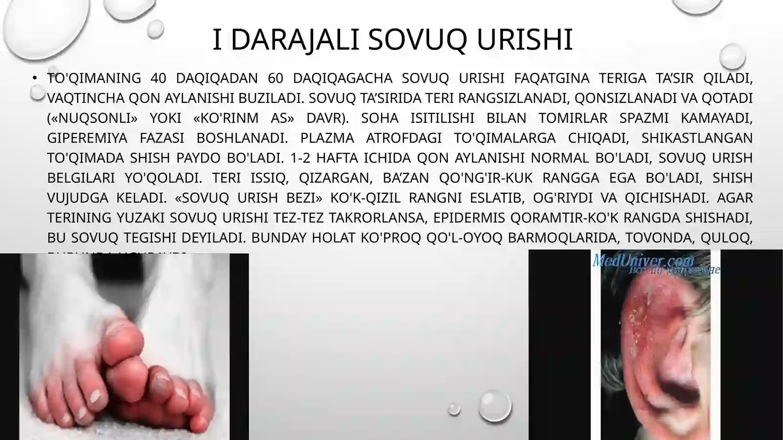 Sovuq urishi 4