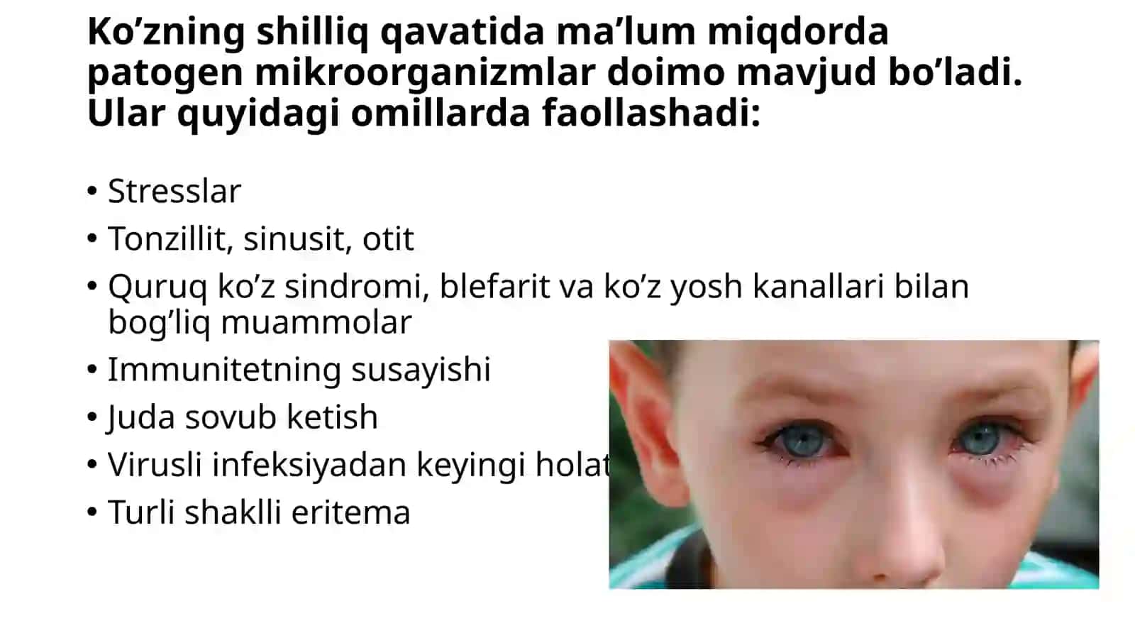 Konyuktivakasalliklari.Tasnifi.Bakterialkonyuktivit 4