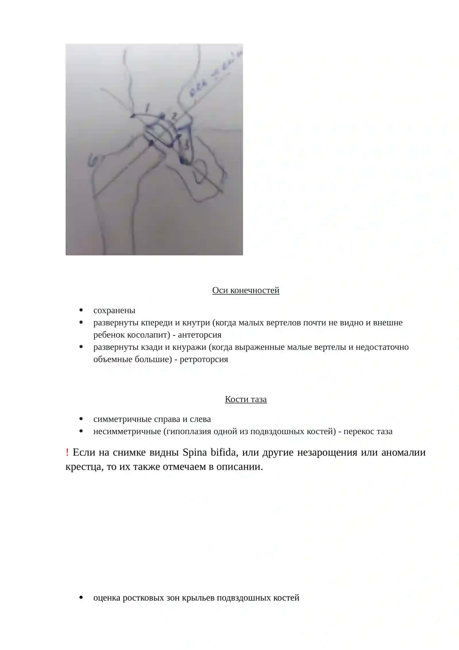 Вертлужные впадины 4