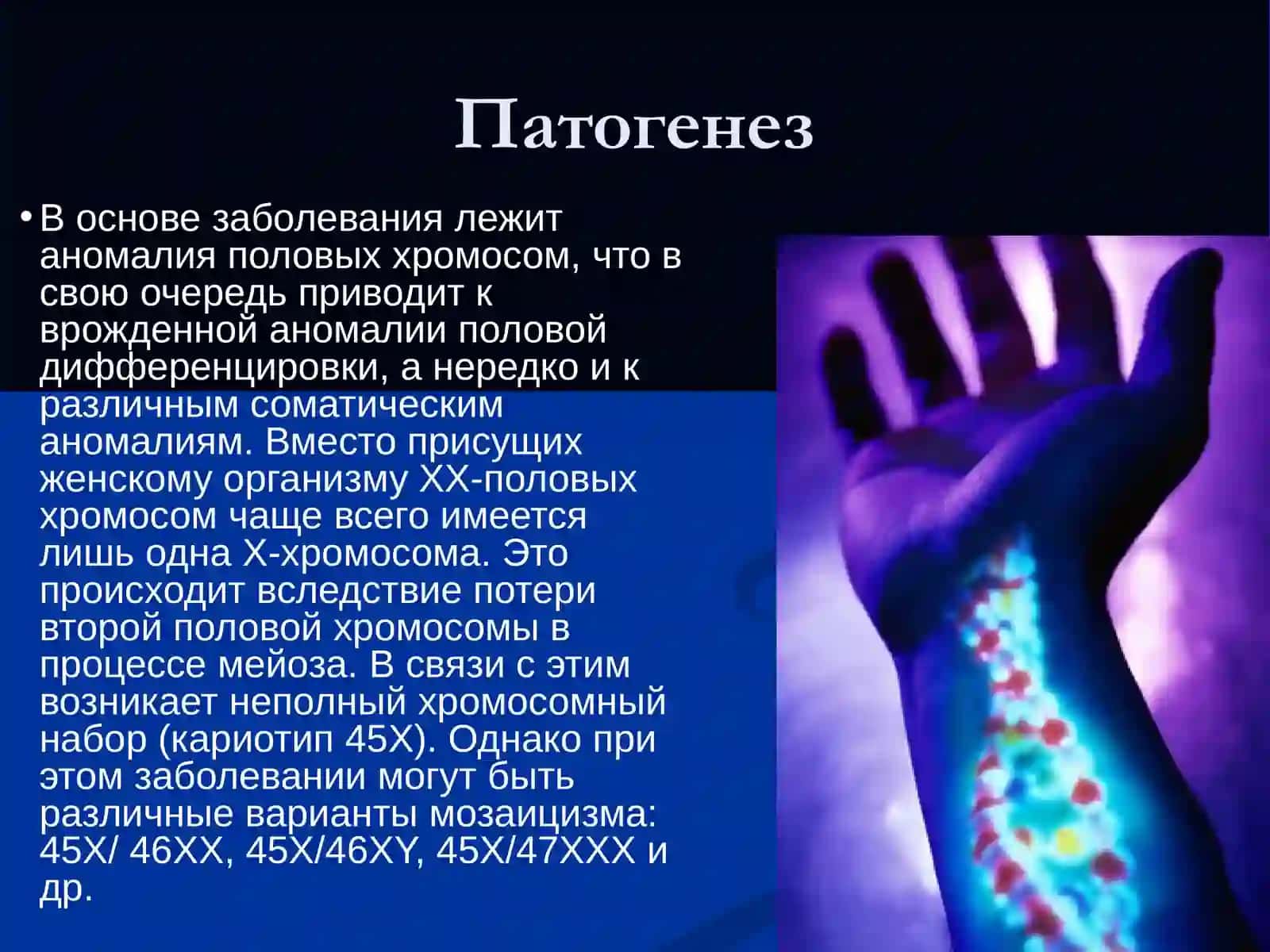 Синдром Шерешевского - Тернера 4