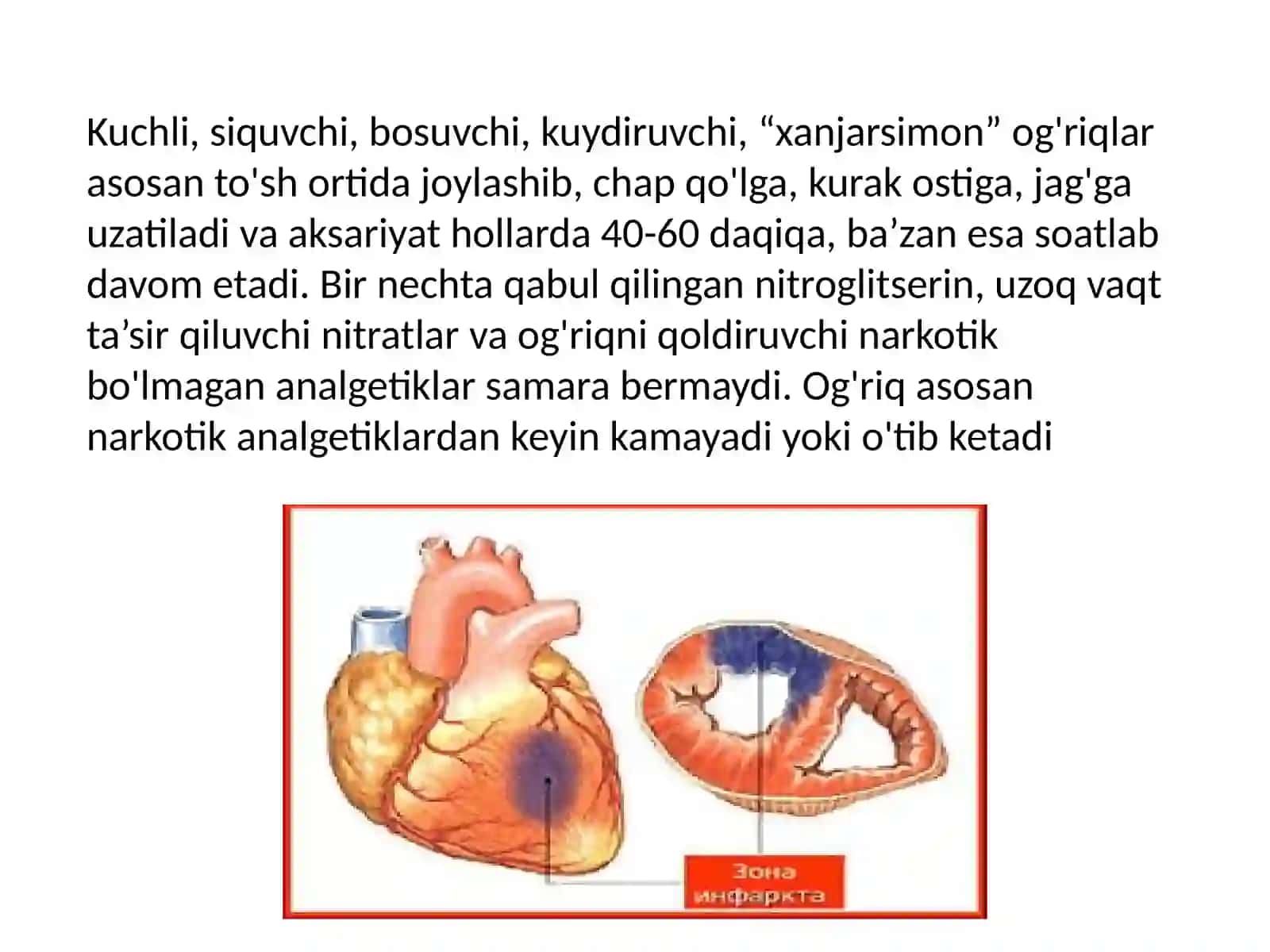 Miokard infarkti etiologiyasi, tasnifi va birinchi yordam algoritmi 4