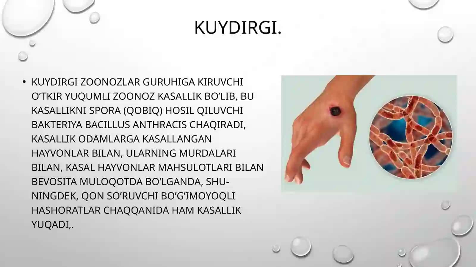 O’ta xavfli karantin infeksiyalarning epidemiologiyasi va profilaktikasi (QKGI, vabo, o’lat, kuydirgi) 4