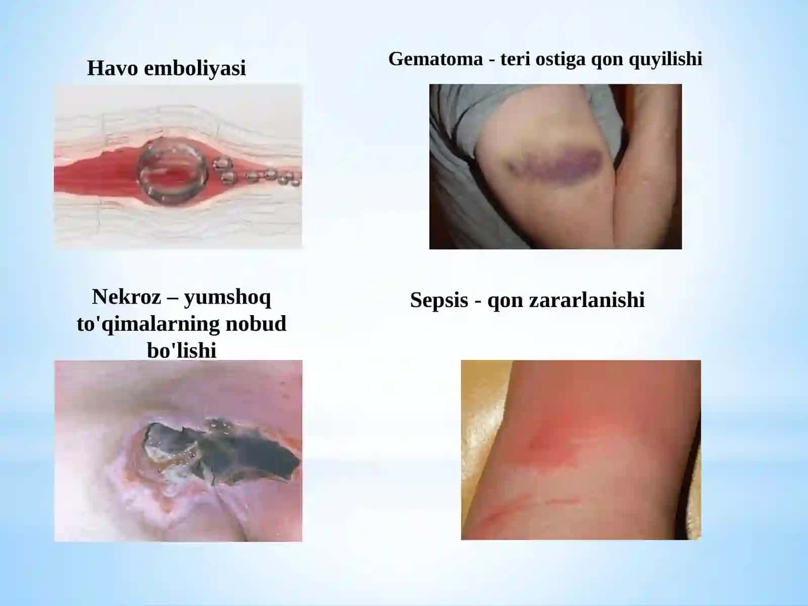 Dori vositalarini parenteral yuborishdagi asoratlar 4