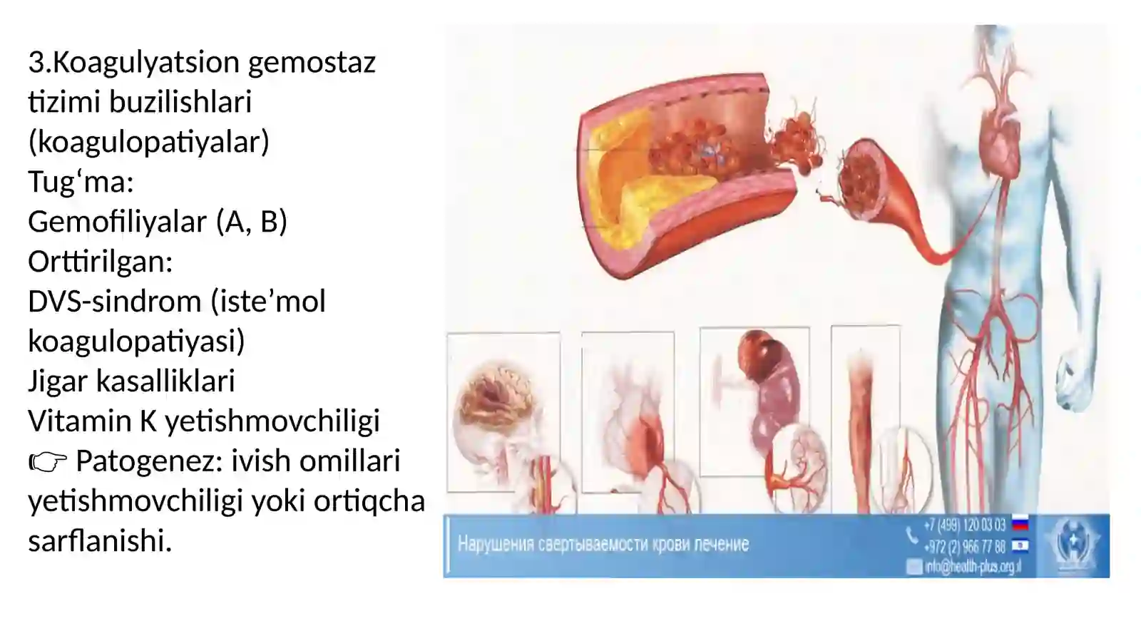 Gemorragik diatezlarning ko’rinishlari 4