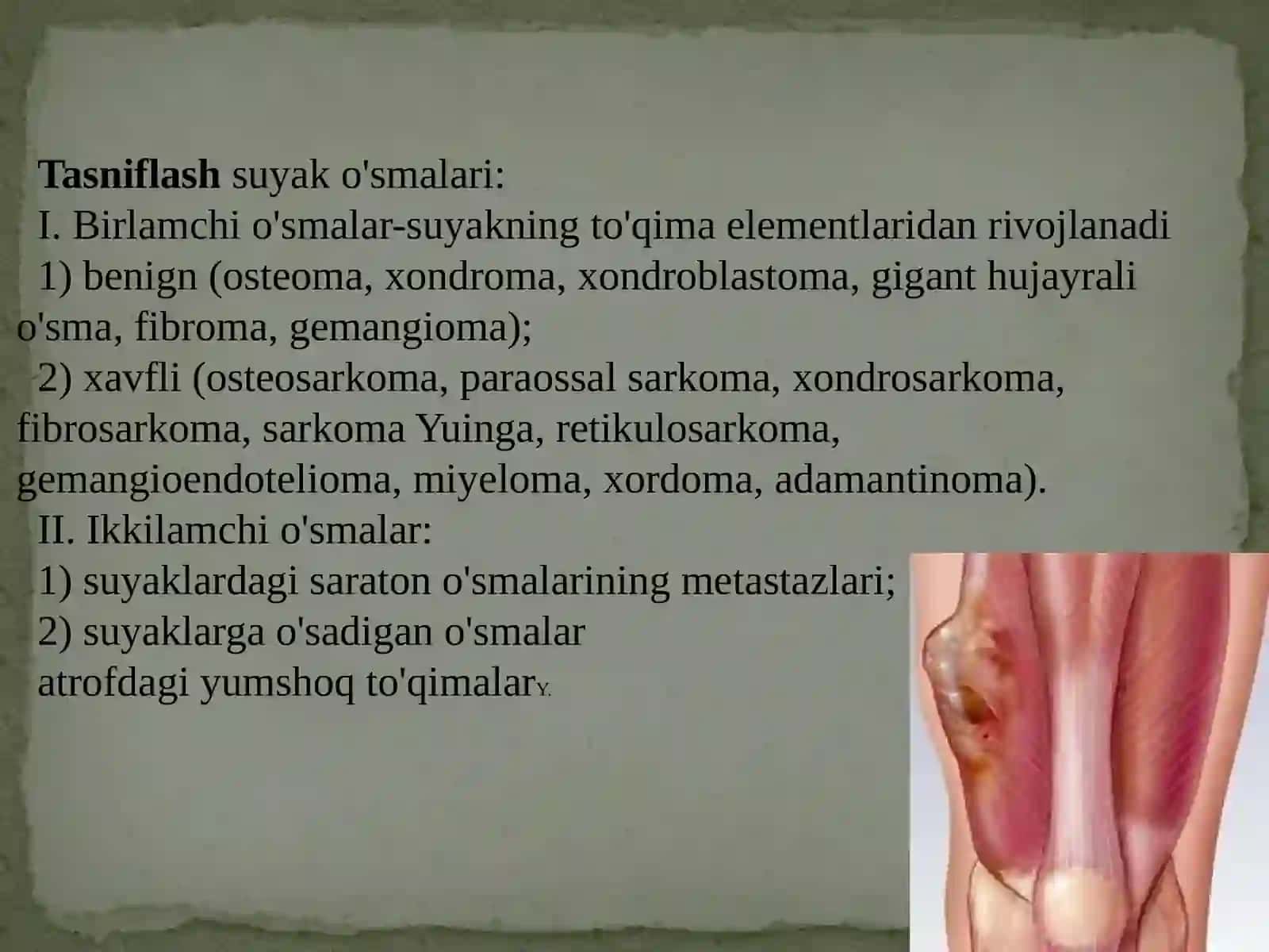 Harakat-tayanch tizimida og'riqli sindromi. Harakat-tayanch tizimida o'smalari 4