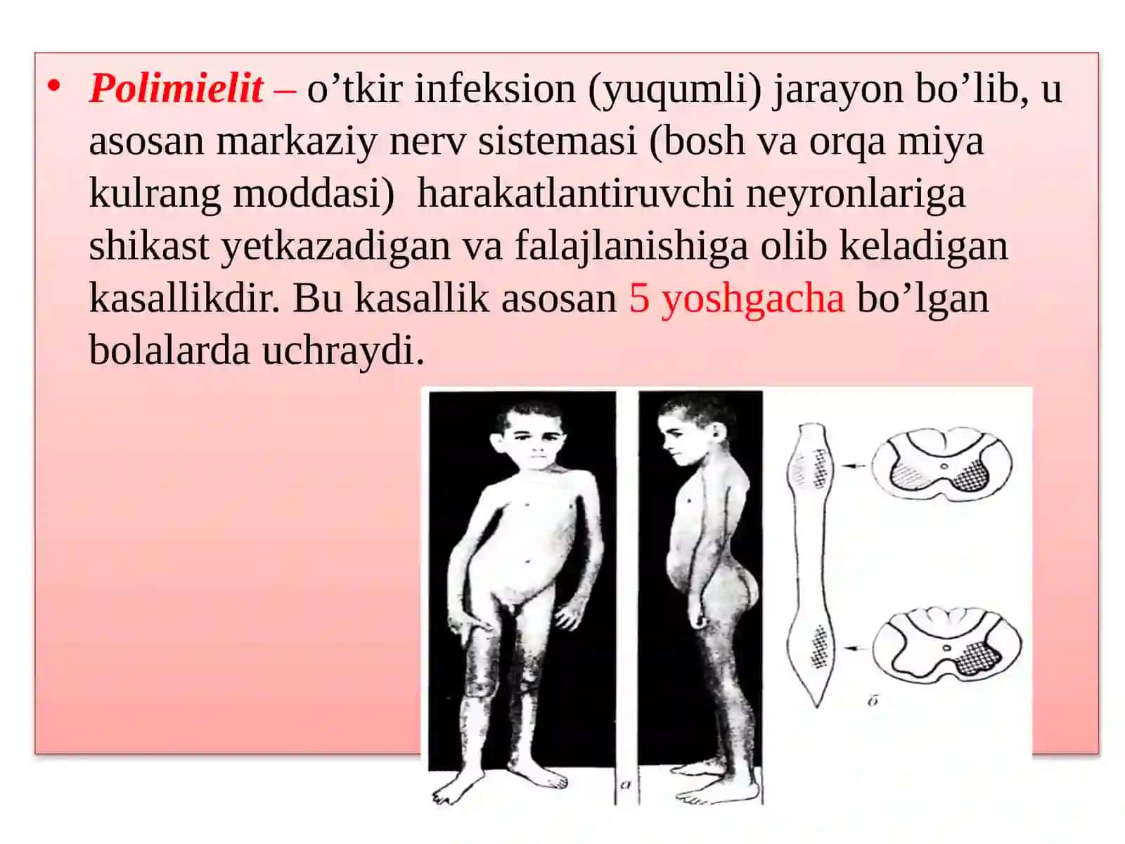 poliomilet kasal odamlarni davolash 4