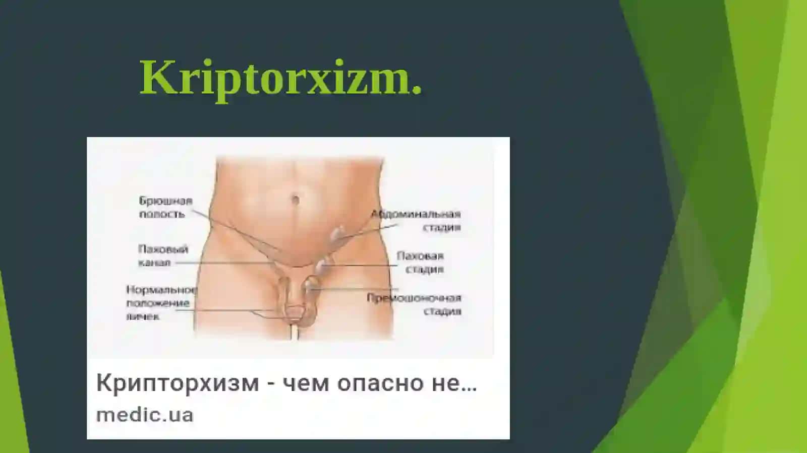 Kriptorxizm 4