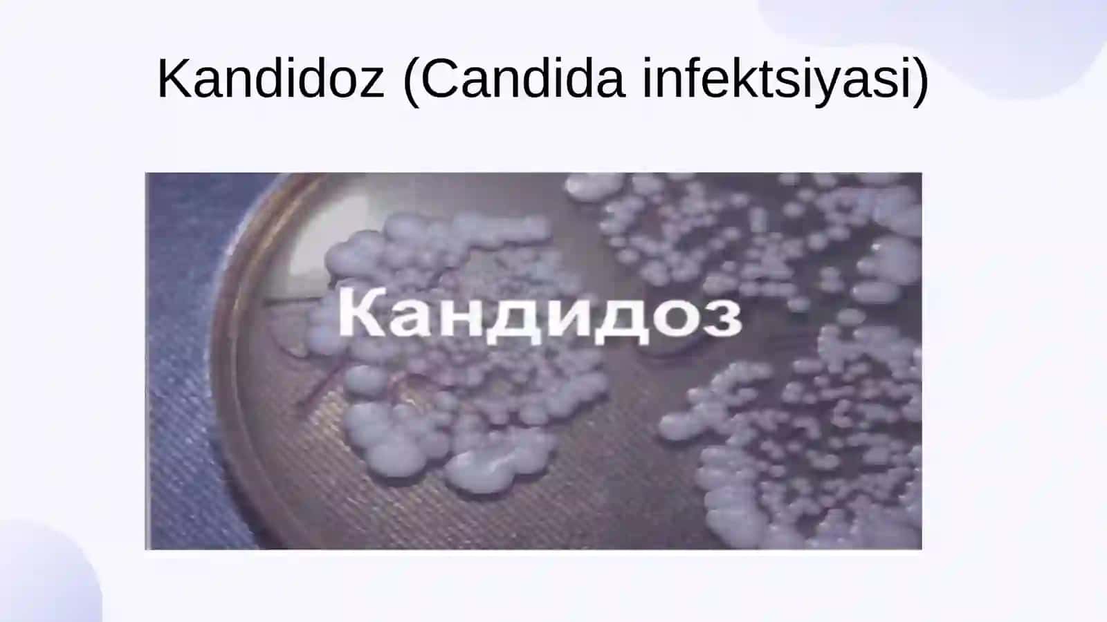 Mavzu: “Zamburug‘ infeksiyalari, Kandidoz va Aspergillez'' 4