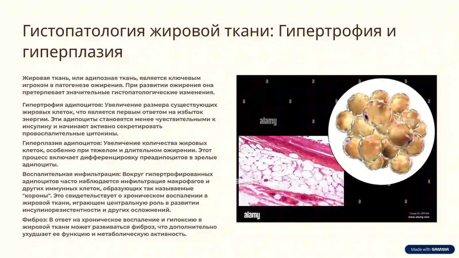 Патологическая анатомия ожирения: Комплексный подход 4
