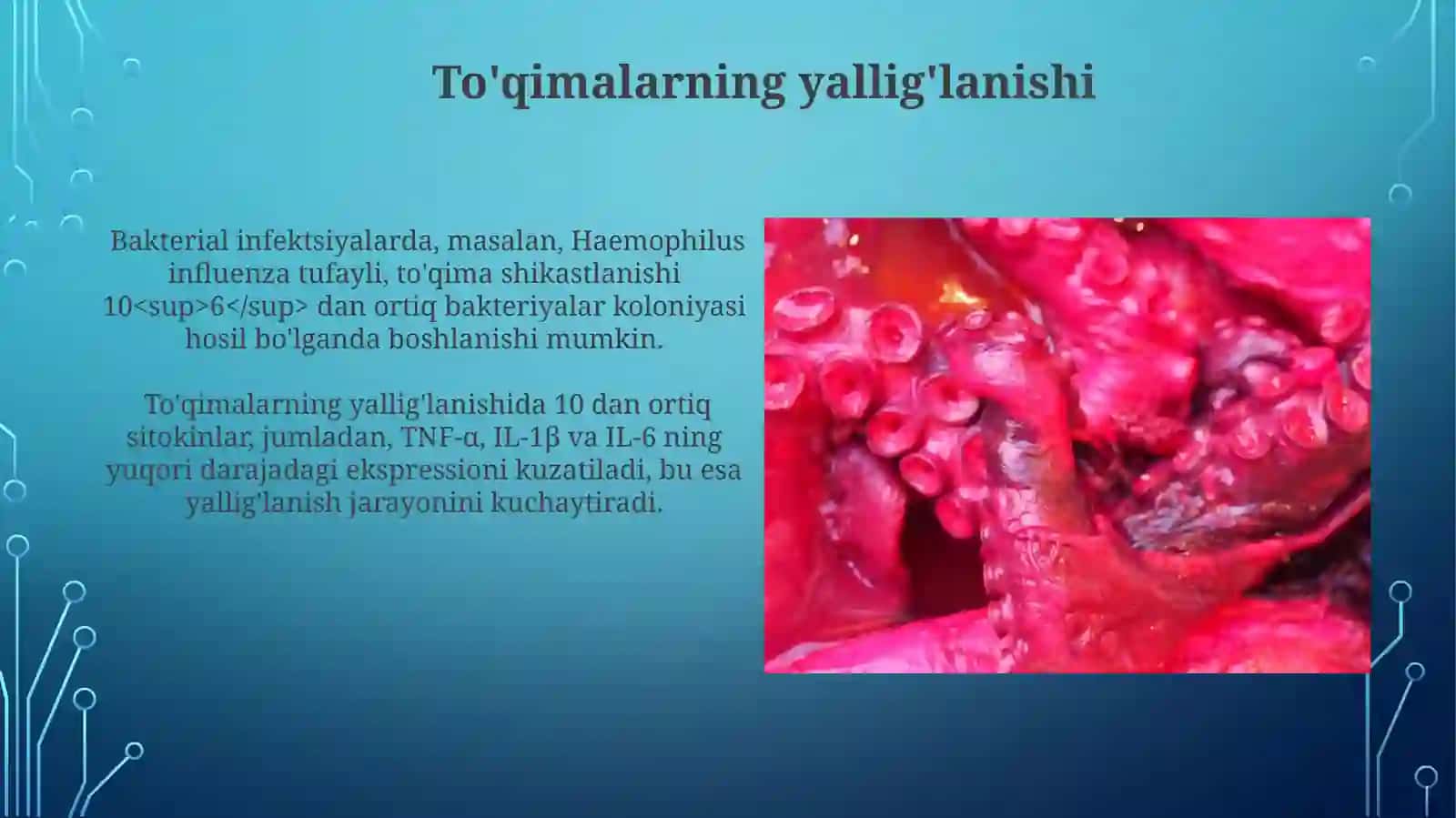 Bronhit kasalligi va Gemofil qo'zg'atuvchilari, patogenez va laboratoriya tashhisi 4