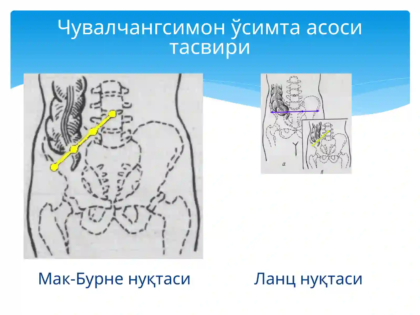 Қорин деворлари клиник анатомияси 4