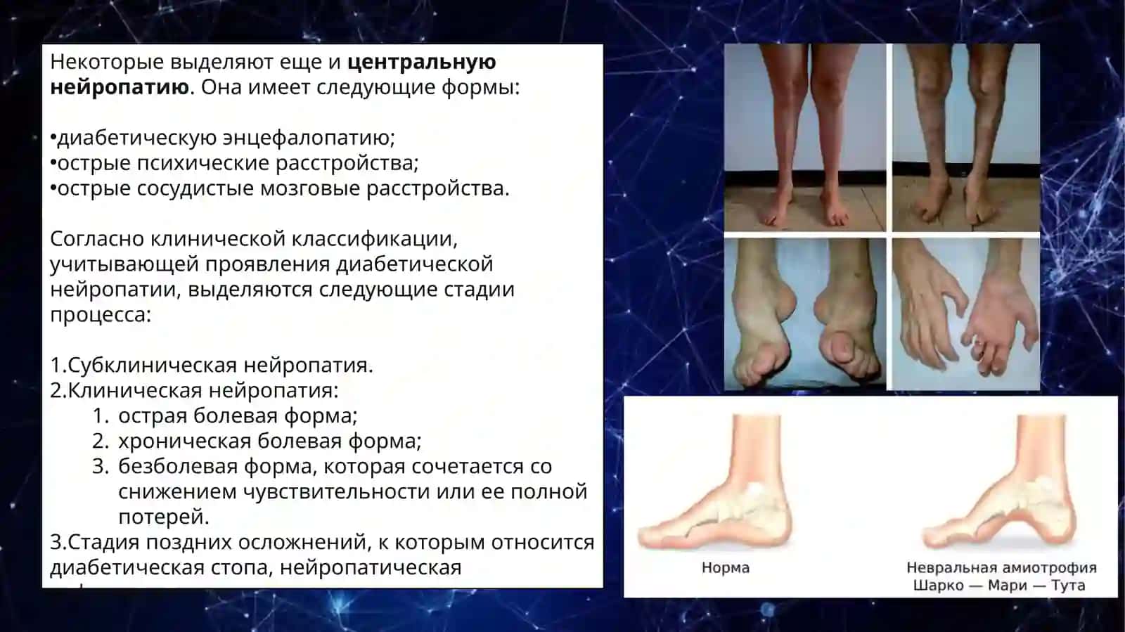 Диабетическая автономнаяпаранейропатия 4