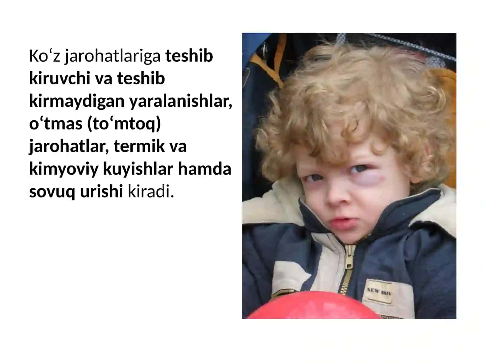Ko’zjaroxatlari 4