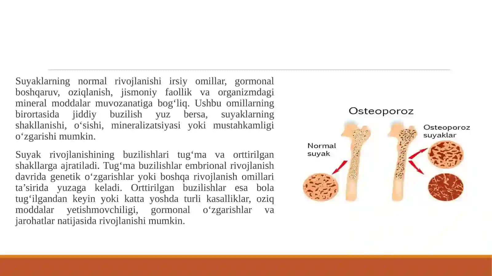 Suyaklarni rivojlanishini buzilishlari. Sinishlar. Osteonekroz kasalligini o‘ziga xosiliklarini tahlil qilish. 4
