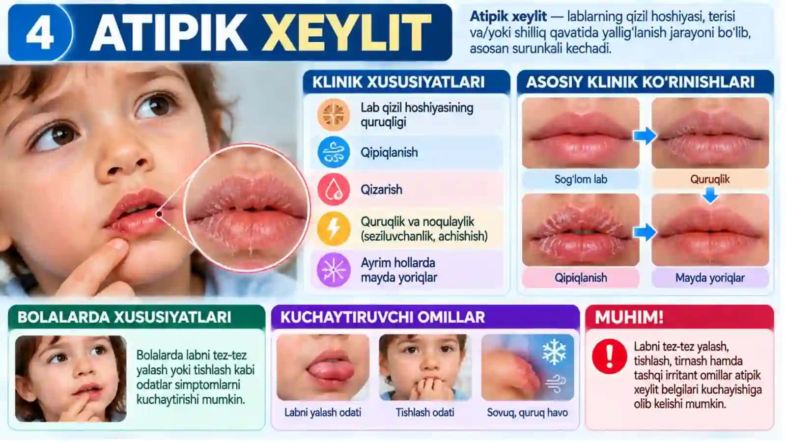 Bolalarda lab kasalliklari Atipik, Ekzematoz va Angulyar xeylitlar Klinik belgilar, tashxis, davolash va profilaktika.pptx 4