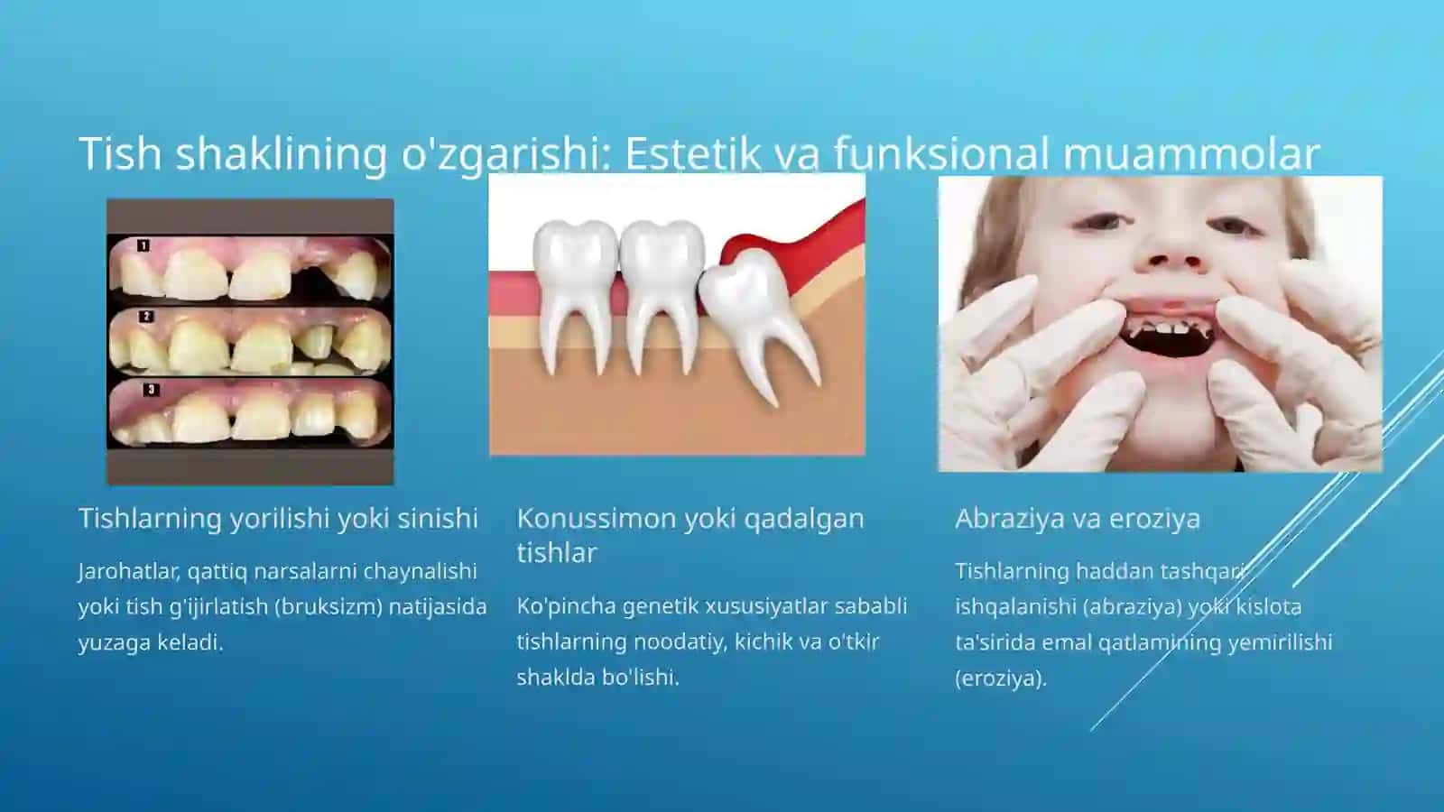 TISHLARNING RANG, SON VA SHAKL O'ZGARISH HOLATLARI 4