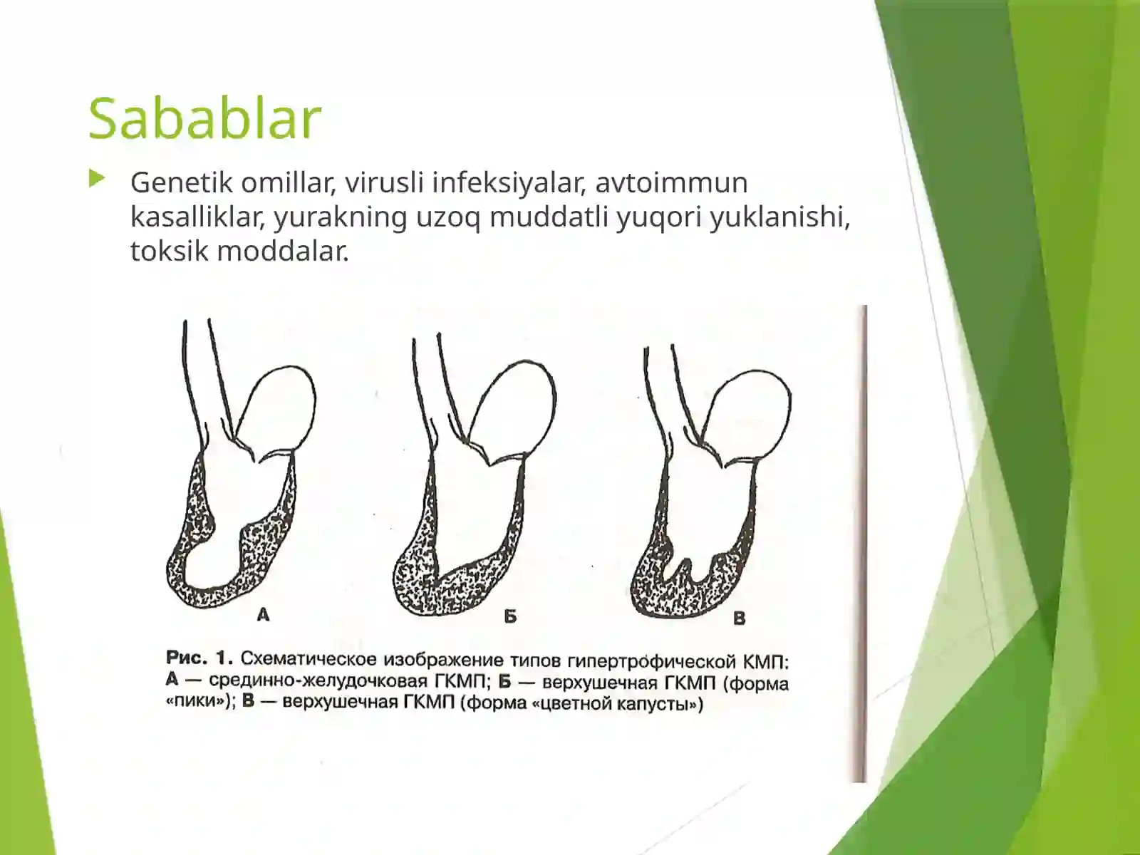 Kardiomiopatiya turlari 4