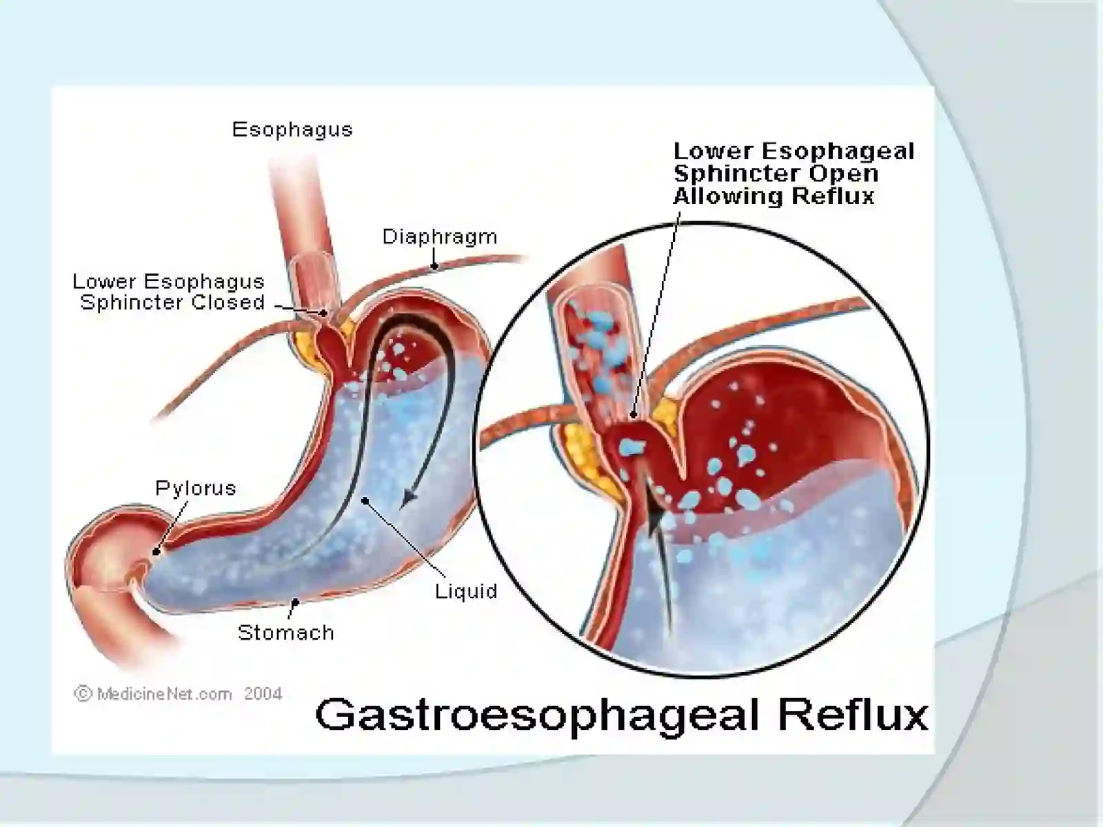 Gastrointestinal diseases 4