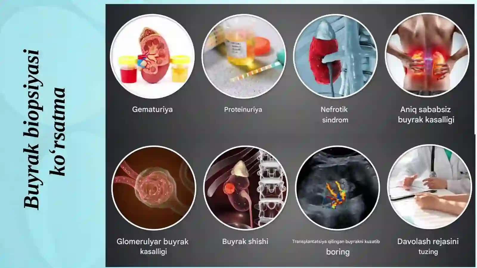 Buyrak biopsiyasi 4