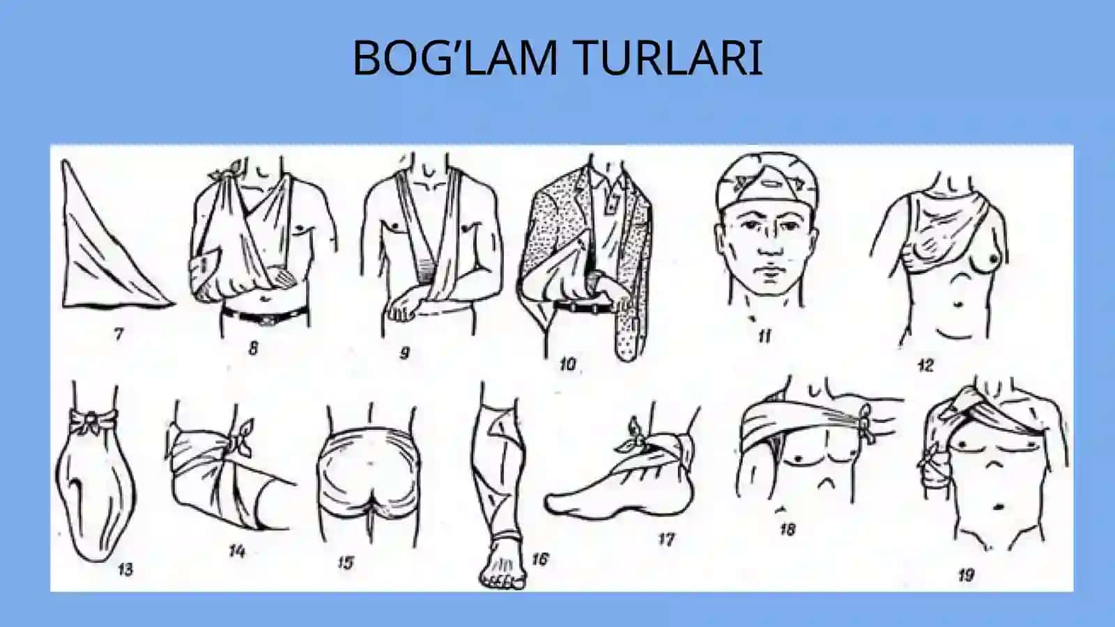 Desmurgiya. Bog’lam turlari. Zamonaviy jaroxat qoplamlari 4