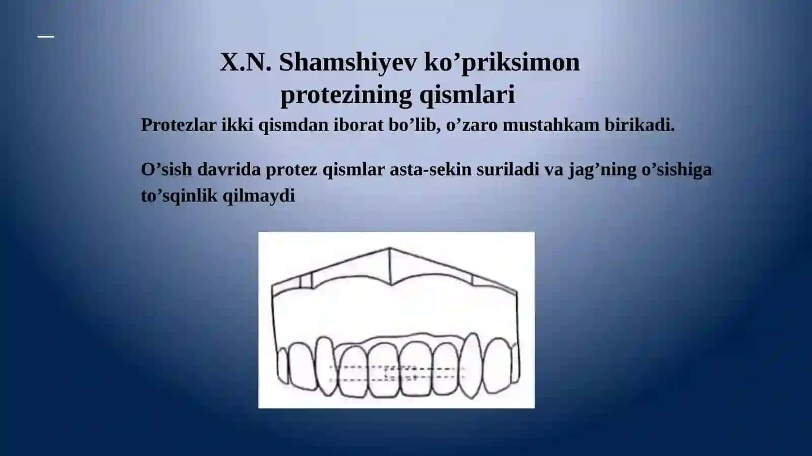 X.N.Shamshiyev ko’priksimon protezi. 4