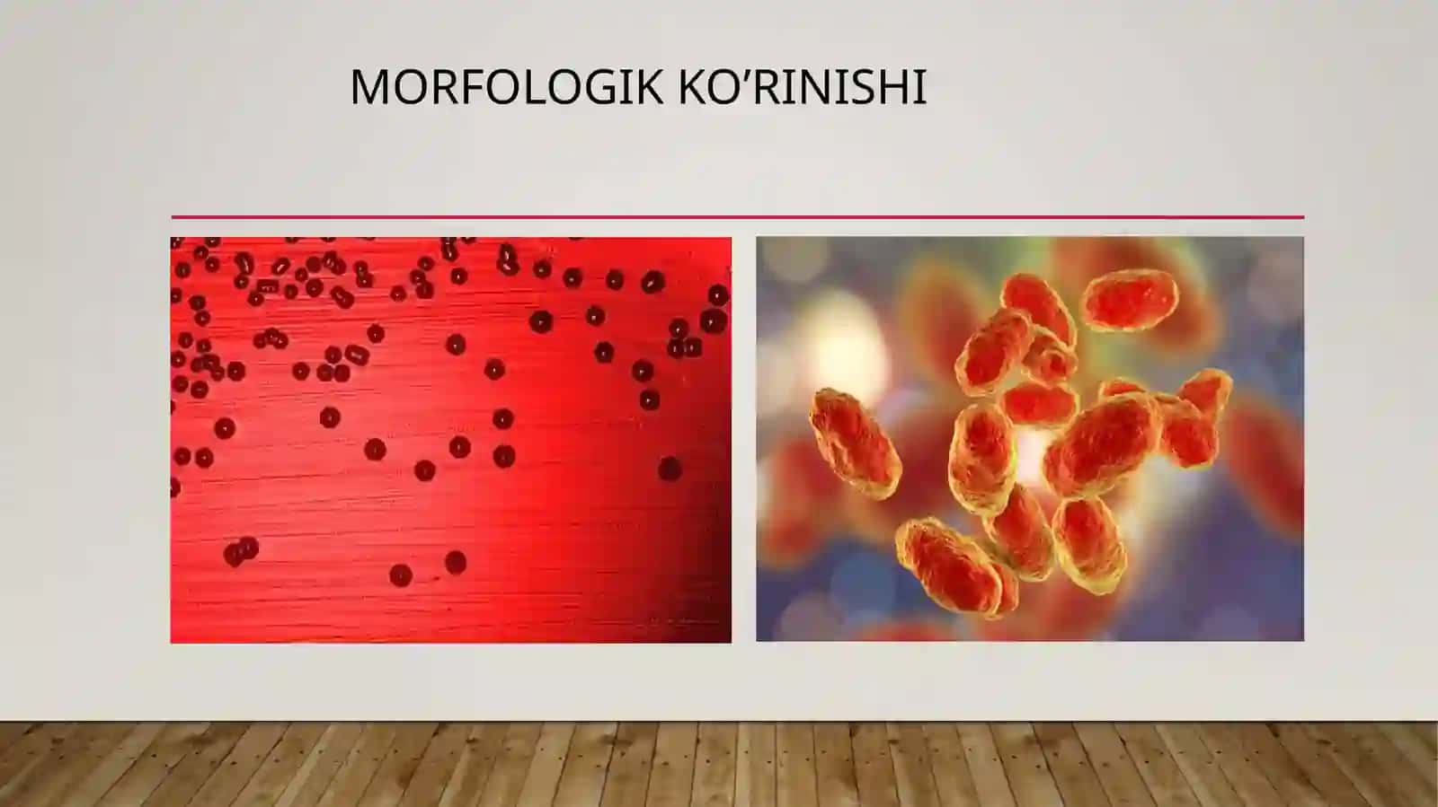 Gemofilbakteriyalar (influyėnsa to'yoğchasi) ūlarni amaliyotdagi ahamiyati, diagnostikasi 4