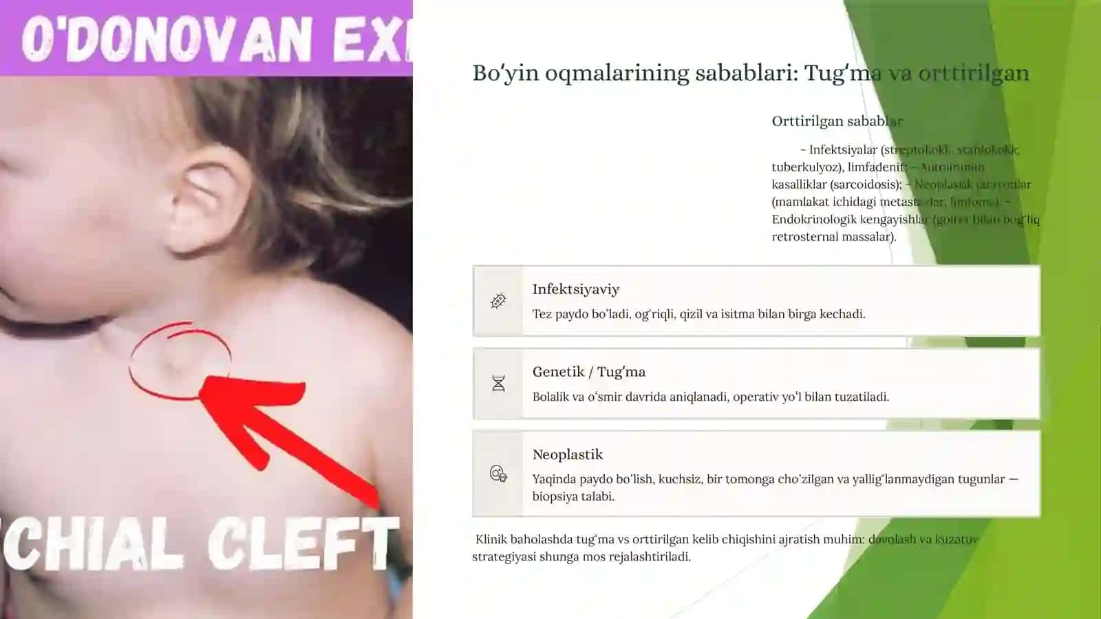 Bo‘yin va jag‘ osti oqmalari 4