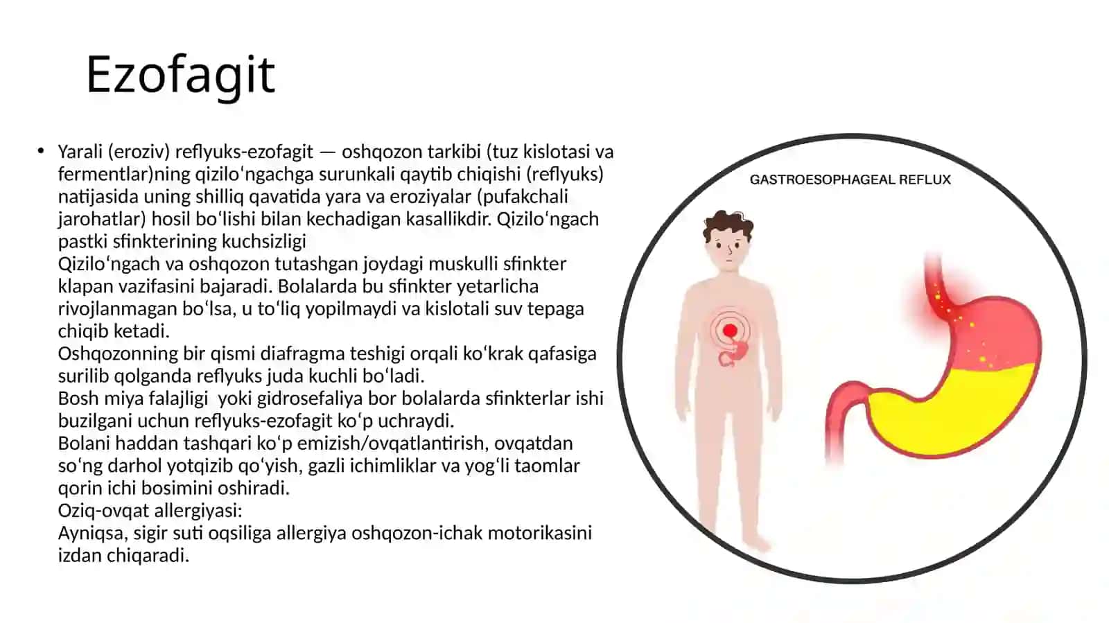 Bolalarda Qizilo`ngachdan qon ketish xolatlari 4